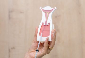 DIU hormonal ou não hormonal? Entenda as diferenças e descubra qual é a melhor opção para você